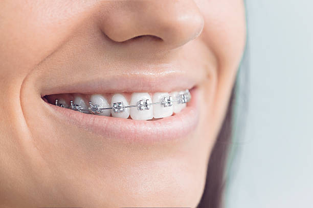 Sleep Apnea Treatment in Siena College, NY